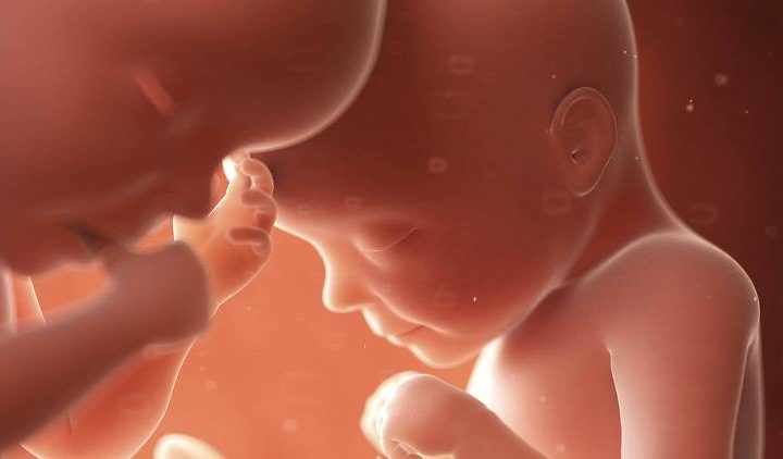 Intervento eccezionale ai Gemelli: bimbo con spina bifida operato nell’utero