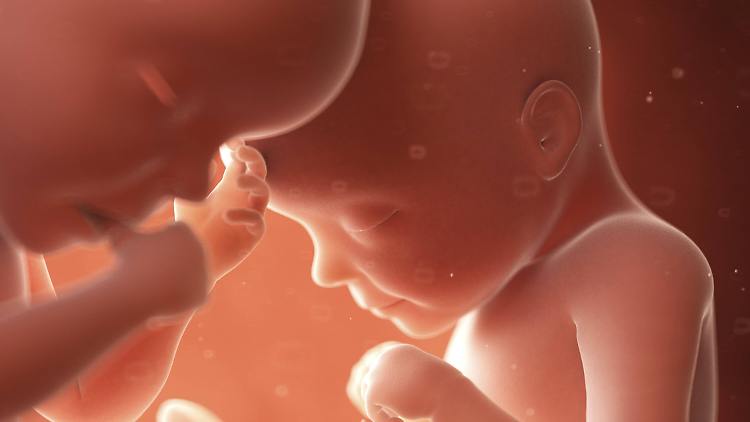 Intervento eccezionale ai Gemelli: bimbo con spina bifida operato nell’utero