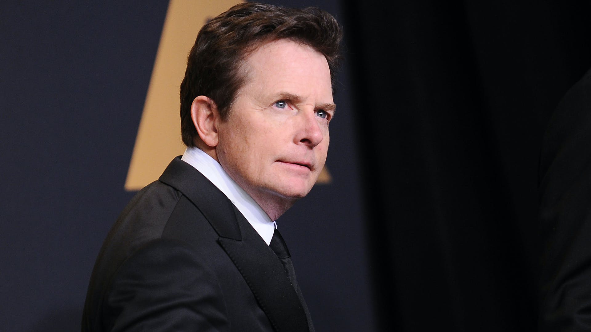 Michael J.Fox svela di aver rischiato la paralisi